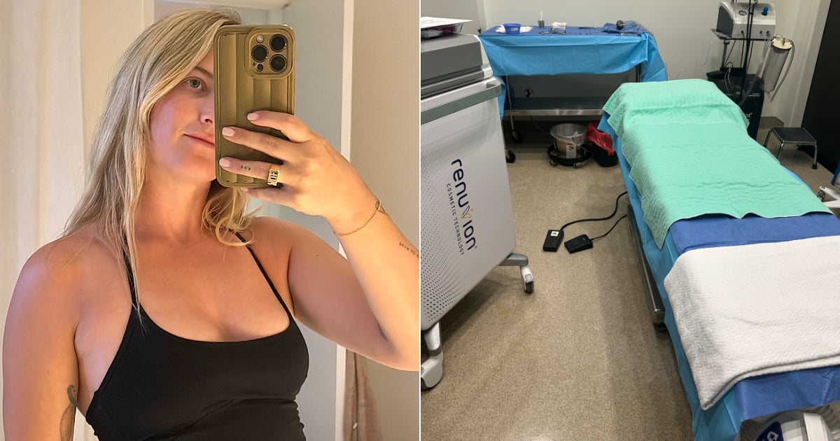 I Got the AirSculpt "Up a Cup" Breast Lift - Here Are My Unfiltered Thoughts