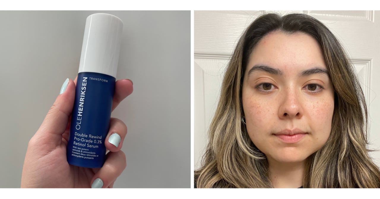 Finally, a Retinol Serum That Doesn't Irritate My Sensitive Skin