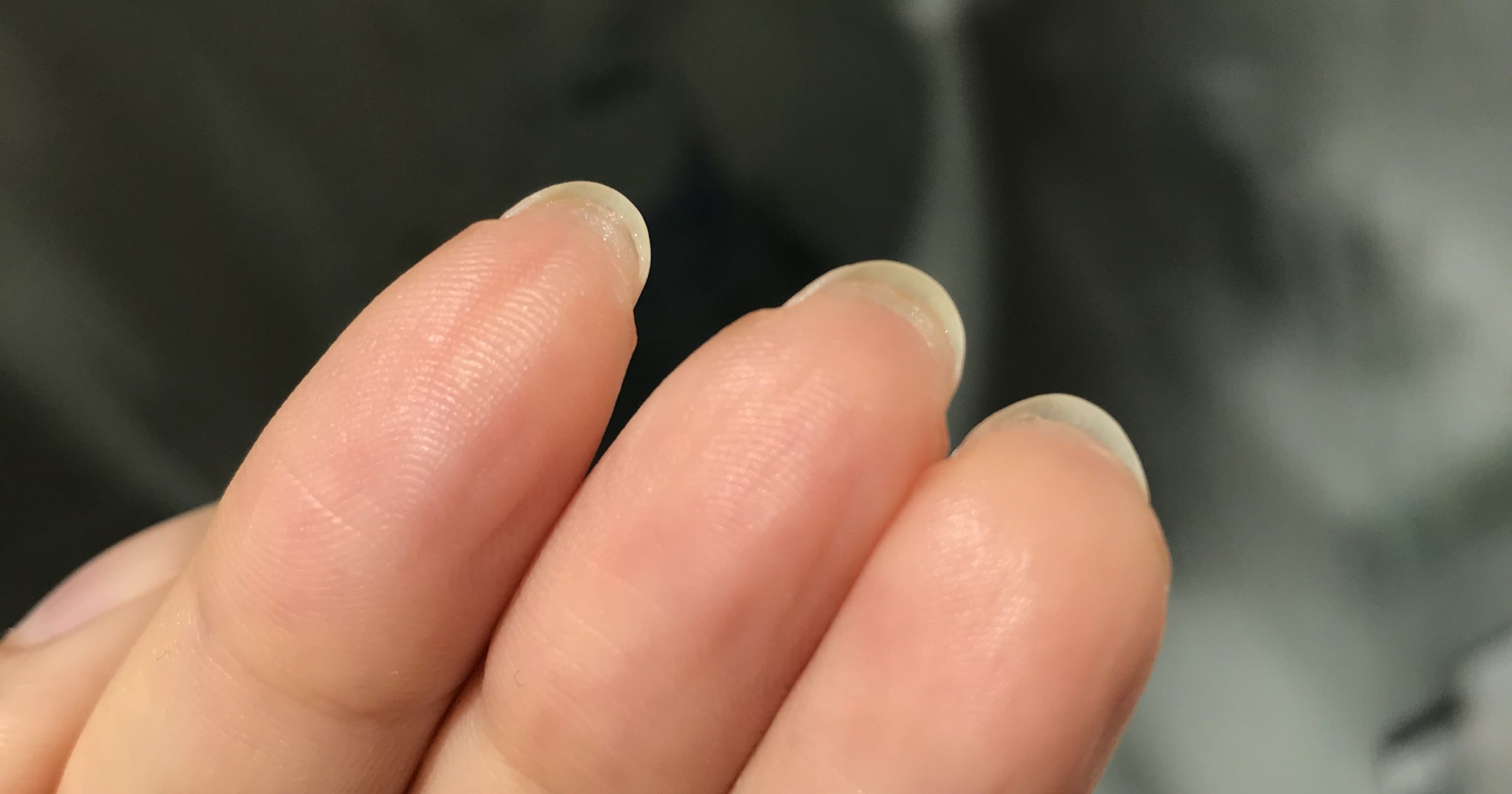 Why You Have Skin Growing Under Your Nails, According to Experts