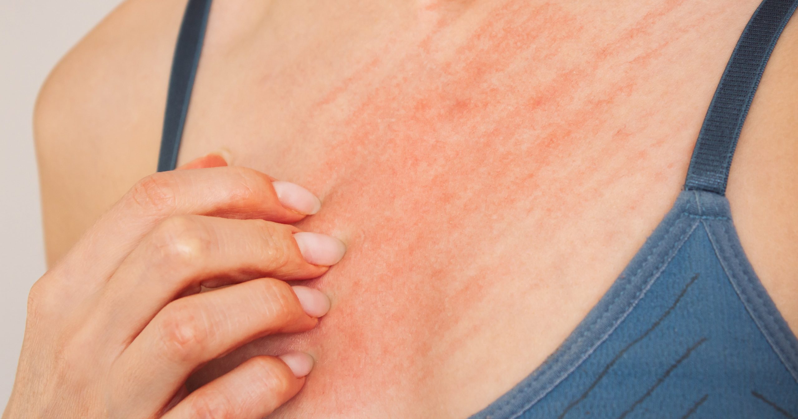 Itchy Nipples? Here Are 9 Potential Causes