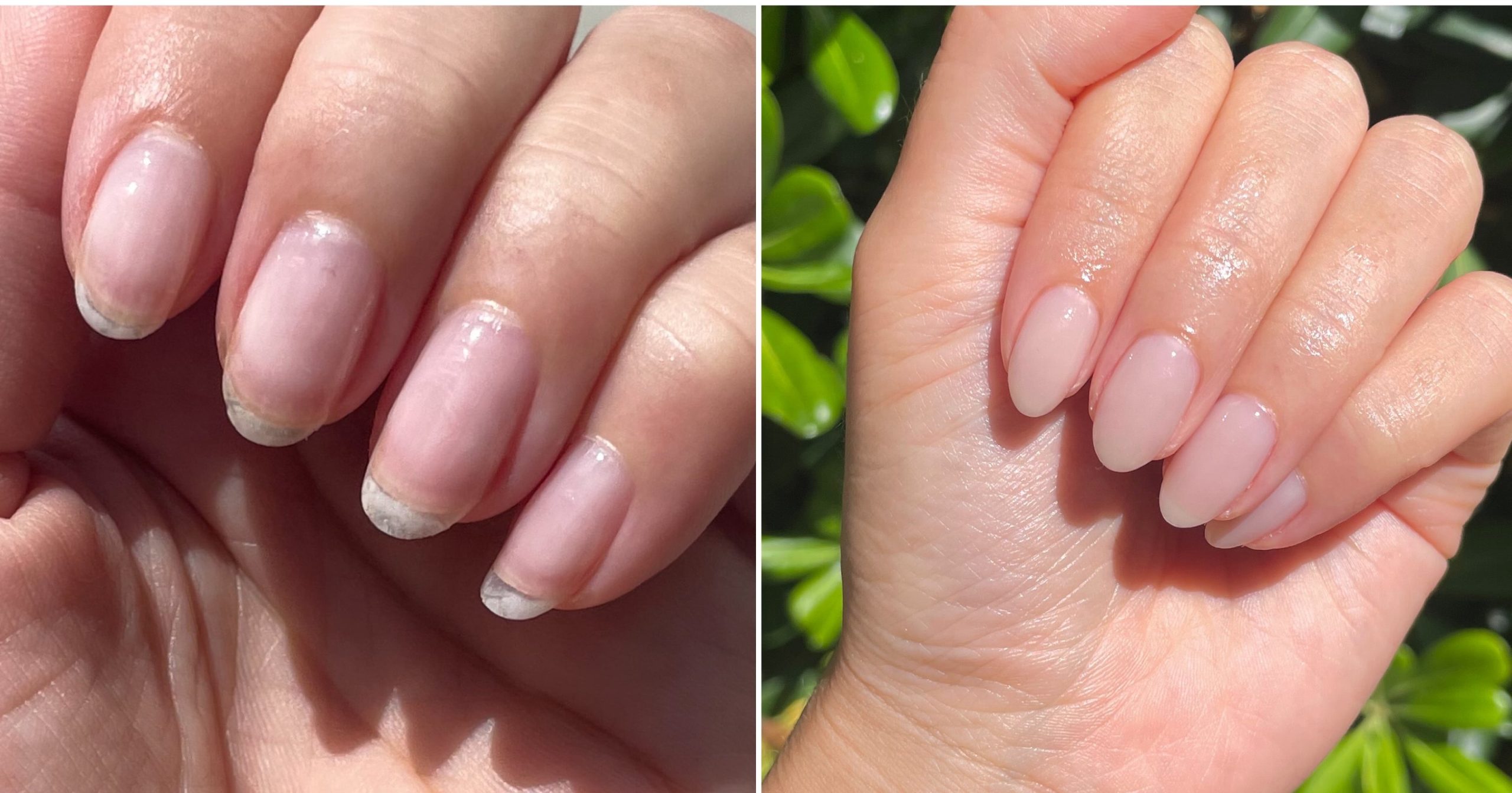 "Nail Cycling" Helped Me Repair Months of Damage