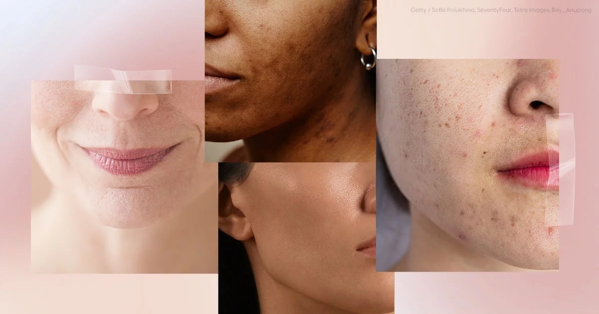 What Is Your Skin Type? Take This Easy Quiz to Find Out